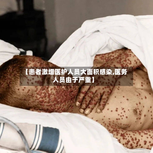 【患者激增医护人员大面积感染,医务人员由于严重】
